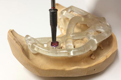 サージカルガイドの作成