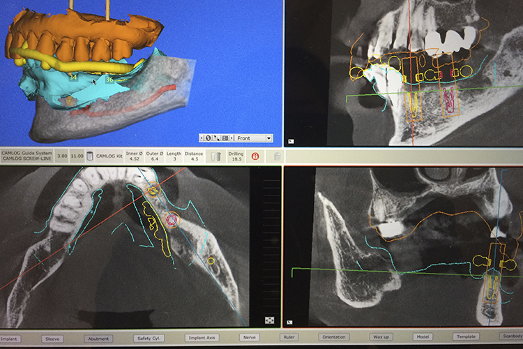 シミュレーション