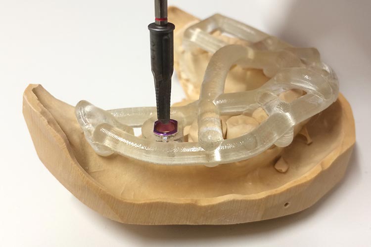 安全性の高い治療