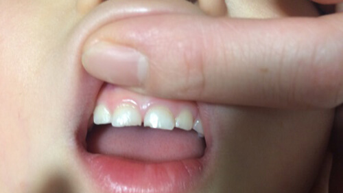 ひとさし指で視野を広げる