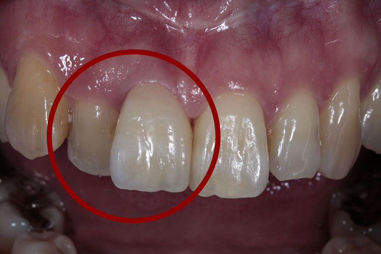 カールツァイス社製マイクロスコープ
